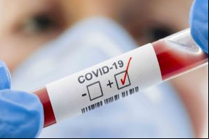 Nesta semana, são registrados 6 casos positivos de covid-19 em São Carlos