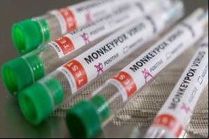 OMS anuncia plano para conter transmissão de mpox