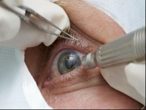 Oftalmologistas alertam para risco de suplementos com promessa de cura